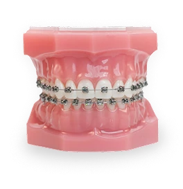 Foto de typodont con brackets de autoligado