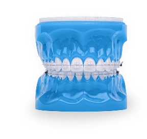 Foto de typodont con brackets de zafiro