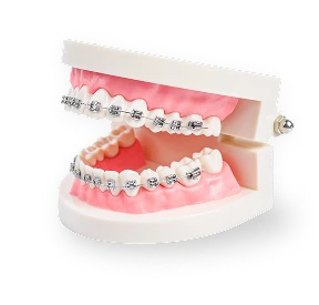 Foto de typodont con brackets metálicos