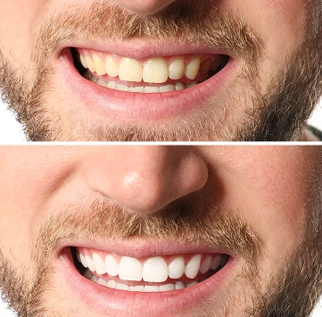 Fotos del antes y después de un paciente