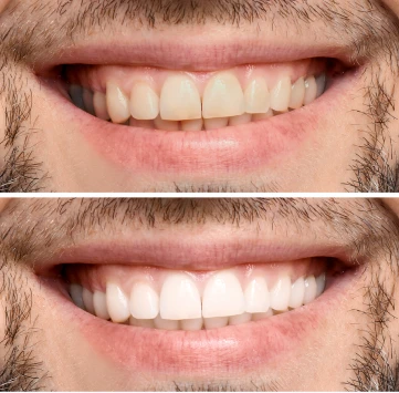 Fotos del antes y después de un paciente