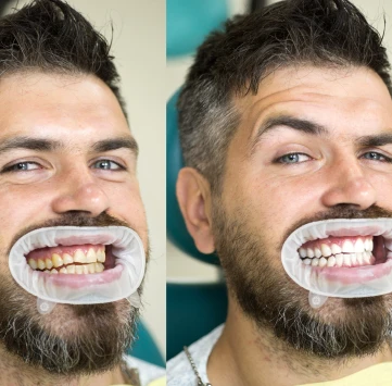 Fotos del antes y después de un paciente