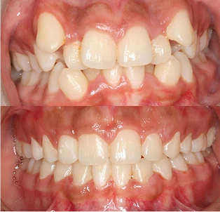 Fotos del antes y después de un paciente