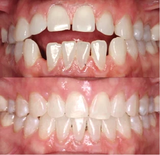 Fotos del antes y después de un paciente