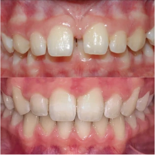 Fotos del antes y después de un paciente