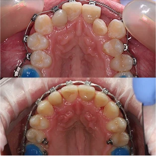 Fotos del antes y después de un paciente