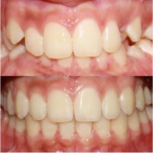 Fotos del antes y después de un paciente