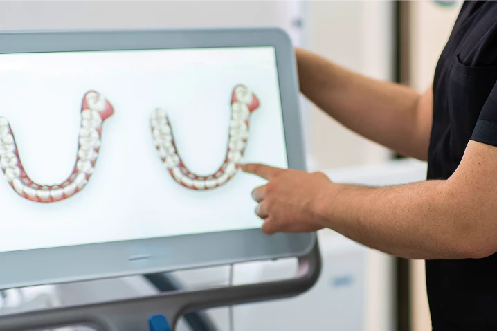 Foto del doctor mostrando una pantalla con scaneo de dentadura